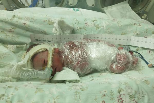 沃格爾：詹姆斯已經(jīng)恢復(fù)了一些訓(xùn)練